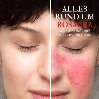 [German] - Alles Rund um Rosacea - Der kleine Ratgeber mit Tipps und Tricks