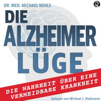 [German] - Die Alzheimer Lüge: Die Wahrheit über eine vermeidbare Krankheit