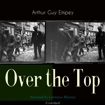 Over the Top: Unabridged sample.