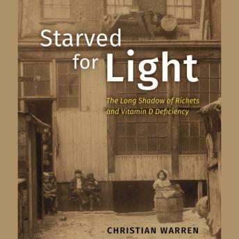 Starved for Light: The Long Shadow of Rickets and Vitamin D Deficiency