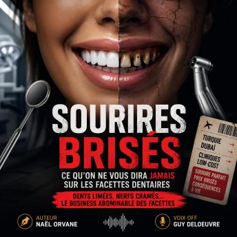 [French] - Sourires brisés : ce qu’on ne vous dira jamais sur les facettes dentaires