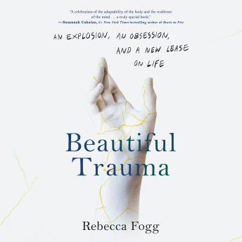Beautiful Trauma: An Explosion, an Obsession, and a New Lease on Life