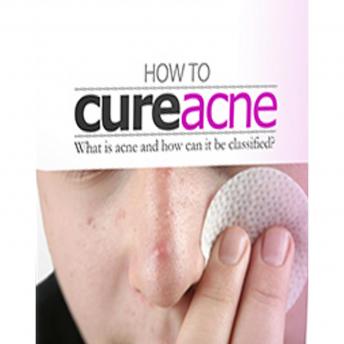 How To Cure Acne: What is acne and how can it be classified?