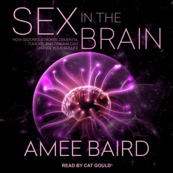 Sex in the Brain: How Seizures, Strokes, Dementia, Tumors, and Trauma Can Change Your Sex Life, Amee Baird