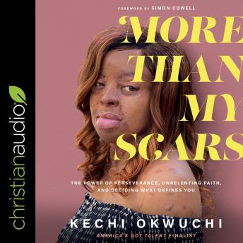 Download More Than My Scars: The Power of Perseverance, Unrelenting Faith, and Deciding What Defines You by Kechi Okwuchi