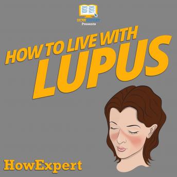 How To Live With Lupus, Howexpert 