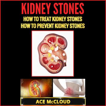 Kidney Stones: How To Treat Kidney Stones: How To Prevent Kidney Stones, Audio book by Ace McCloud