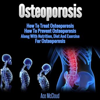 Osteoporosis: How To Treat Osteoporosis: How To Prevent Osteoporosis: Along With Nutrition, Diet And Exercise For Osteoporosis, Audio book by Ace McCloud