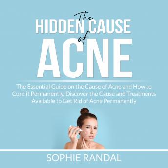 The Hidden Cause of Acne: the Essential Guide on the Cause of Acne and How to Cure it Permanently, Discover the Cause and Treatments Available to Get Rid of Acne Permanently