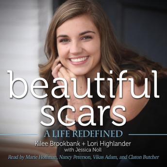 Beautiful Scars: A Life Redefined, Lori Highlander, Kilee Brookbank