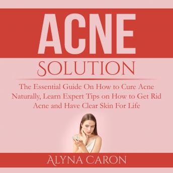 Acne Solution: The Essential Guide On How to Cure Acne Naturally, Learn Expert Tips on How to Get Rid Acne and Have Clear Skin For Life