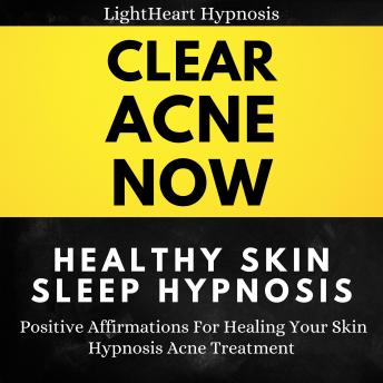 Clear Acne Now Healthy Skin Sleep Hypnosis: Positive Affirmations For Healing Your Skin. Hypnosis Acne Treatment