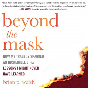 Beyond the Mask: How My Tragedy Sparked an Incredible Life: Lessons I Might Never Have Learned