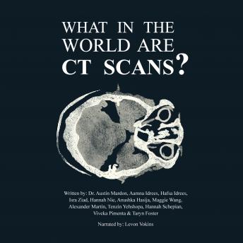 Download What in the World are CT Scans? by Anushka Hasija, Dr. Austin Mardon, Aamna Idrees, Hafsa Idrees, Isra Ziad, Hannah Nie, Maggie Wang, Alexande Rmartin, Tenzin Yehshopa, Hannah Schepian, Viveka Pimenta