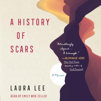 History of Scars: A Memoir sample.