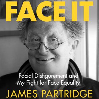 Face It: Facial Disfigurement and My Fight For Face Equality