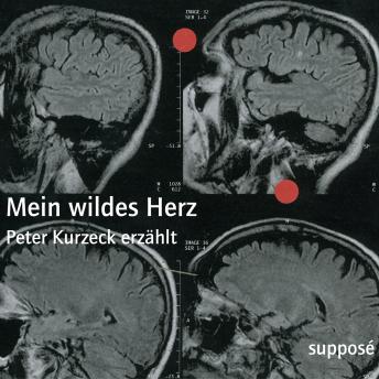 [German] - Mein wildes Herz: Peter Kurzeck erzählt