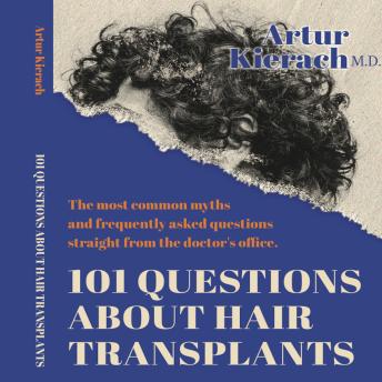 101 questions about hair transplants