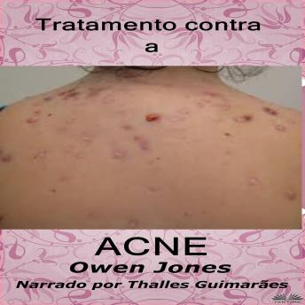 [Portuguese] - Tratamento Contra A Acne