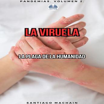 [Spanish] - La Viruela
