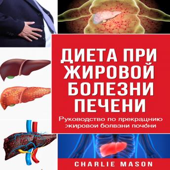 [Russian] - Диета при жировой дистрофии печени. Руководство по лечению заболеваний печени.