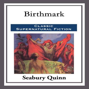Birthmark