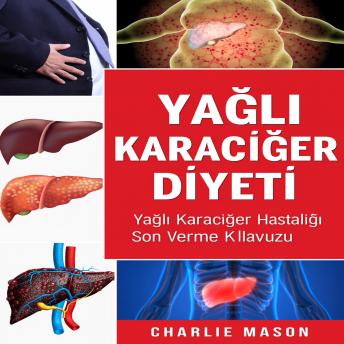 [Turkish] - Yağlı Karaciğer Diyeti. Karaciğer Hastalığına Son Verme Rehberi