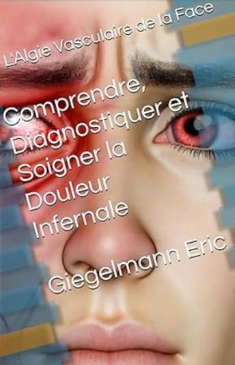 [French] - L'Algie Vasculaire de la Face: Comprendre, Diagnostiquer et Soigner la Douleur Infernale