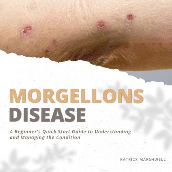 Morgellons Disease: A Beginner's Quick Start Guide to Understanding and Managing the Condition