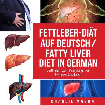[German] - Fettleber-Diät Auf Deutsch/ Fatty liver diet In German: Leitfaden zur Beendung der Fettleberkrankheit (German Edition)