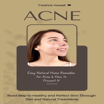 Acne: Easy Natural Home Remedies for Acne & How to Prevent It (Road Map to Healthy and Perfect Skin Through Diet and Natural Treatments)