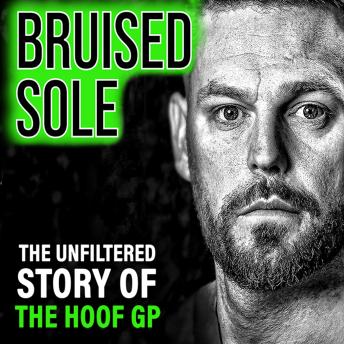 Bruised Sole: The Unfiltered Story of The Hoof GP