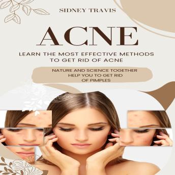 Download Acne: Learn the Most Effective Methods to Get Rid of Acne (Nature and Science Together Help You to Get Rid of Pimples) by Sidney Travis