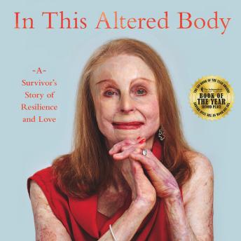 In This Altered Body: A Survivor’s Story of Resilience and Love