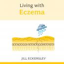Living with Eczema