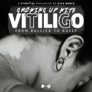 Growing Up With Vitiligo, I Was Bullied—Until I Became A Bully Audiobook