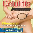 Celulitis Audiobook