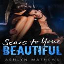 Scars to Your Beautiful Audiobook