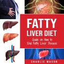 Fatty Liver Diet: Guide on How to End Fatty Liver Disease Fatty Liver Diet Books: Fatty Liver Diet Audiobook