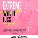 Extreme Rapid Weight Loss Hypnosis: The Complete Guide for a Natural Weight Loss With Powerful Hypno Audiobook