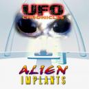 UFO Chronicles - Alien Implants Audiobook